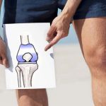 فیزیوتراپی تعویض مفصل زانو