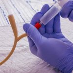 سوندگذاری در منزل برای بیماران