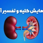 آزمایش های بیماری کلیوی بانوان و آقایان در منزل