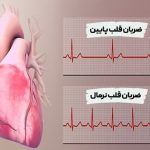 ضربان قلب پایین خطرناک چند است؟