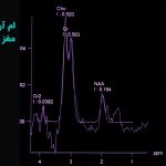 ام آر اسپکتروسکوپی (MRS)