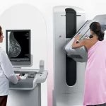 ماموگرافی چیست و چگونه انجام می‌شود؟