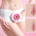 رفع تیرگی واژن| بایدها و نبایدهای سفید کردن واژن