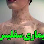 سفلیس چیست؟ | علائم و راهها
