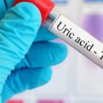 آزمایش اسید اوریک (Uric acid) چیست؟