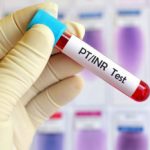 آزمایش PT چیست؟ بررسی تست PT