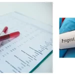 آزمایش پروژسترون: انواع، تفسیر نتایج