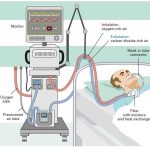 آشنایی با دستگاههای رایج در ICU: ونتیلاتور، مانیتور، پمپ سرم و دیگر تجهیزات حیاتی